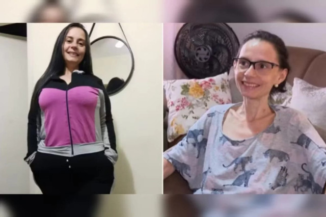 A patient undergoes obesity surgery after his weight reached 36 kg and he suffered from severe anemia  News